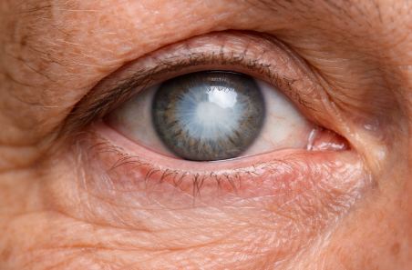 Как уберечься от катаракты