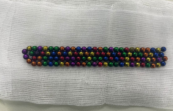 105 магнитных шариков извлекли из желудка двухлетнего ребенка в Алматы