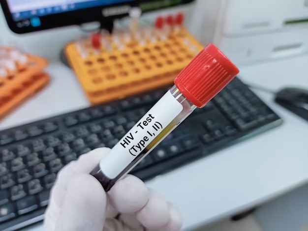 В Актюбинской области с начала года зафиксировано 52 случая ВИЧ-инфекции