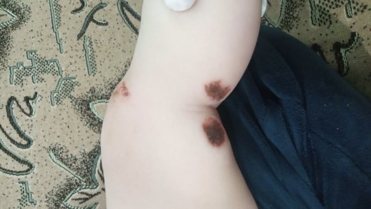 В Павлодаре две девочки обожглись чистящим средством