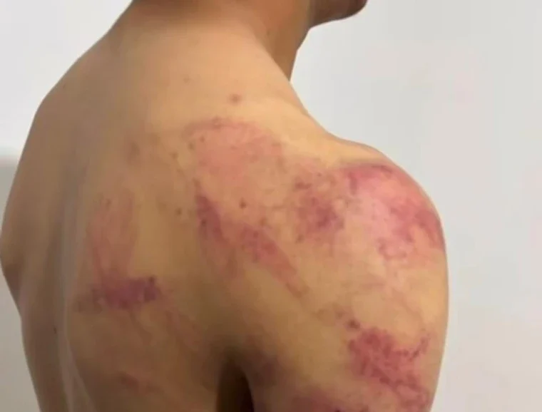 Подростки побили палками учеников младших классов в заброшенном здании в Атырау