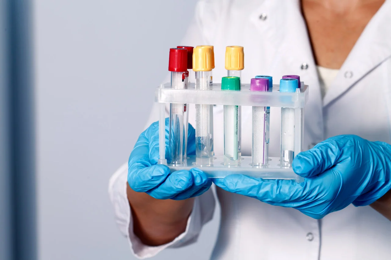 С помощью ДНК-тестов идентифицировали тела 32 жертв крушения самолёта Air India