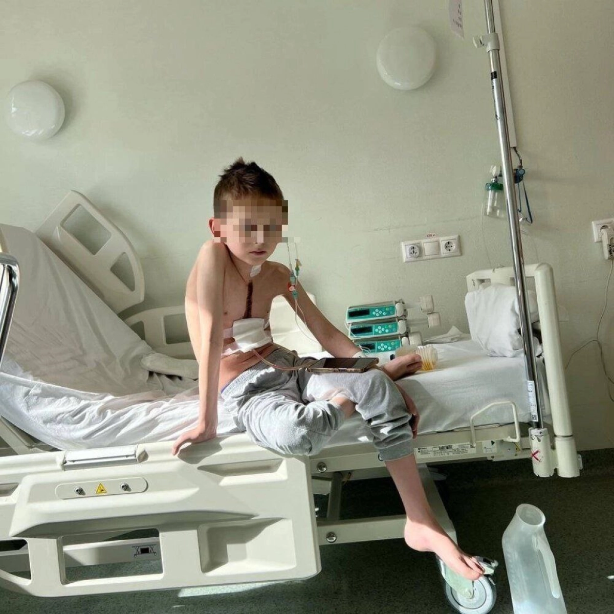 Новосибирские врачи забыли в теле мальчика из Кокшетау полуметровую струну