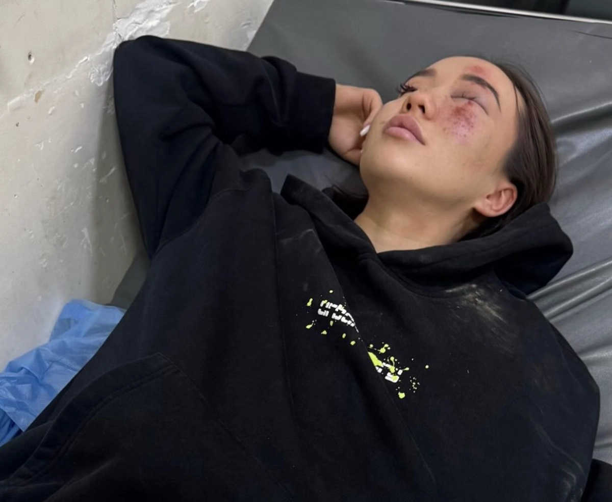 Астанчанка обвинила конный клуб в халатности после жесткого падения с лошади