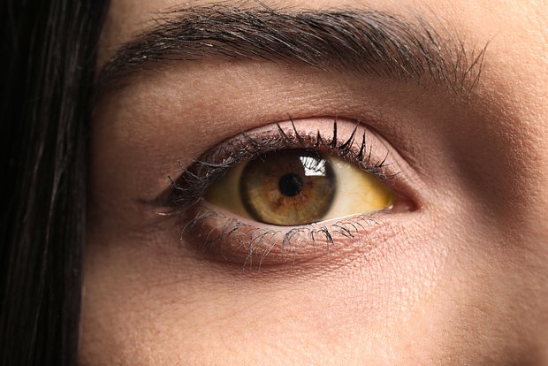 Названа указывающая на рак деталь на теле