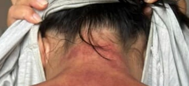 "Калечит людей" — жительница Актау обвинила массажиста в насилии