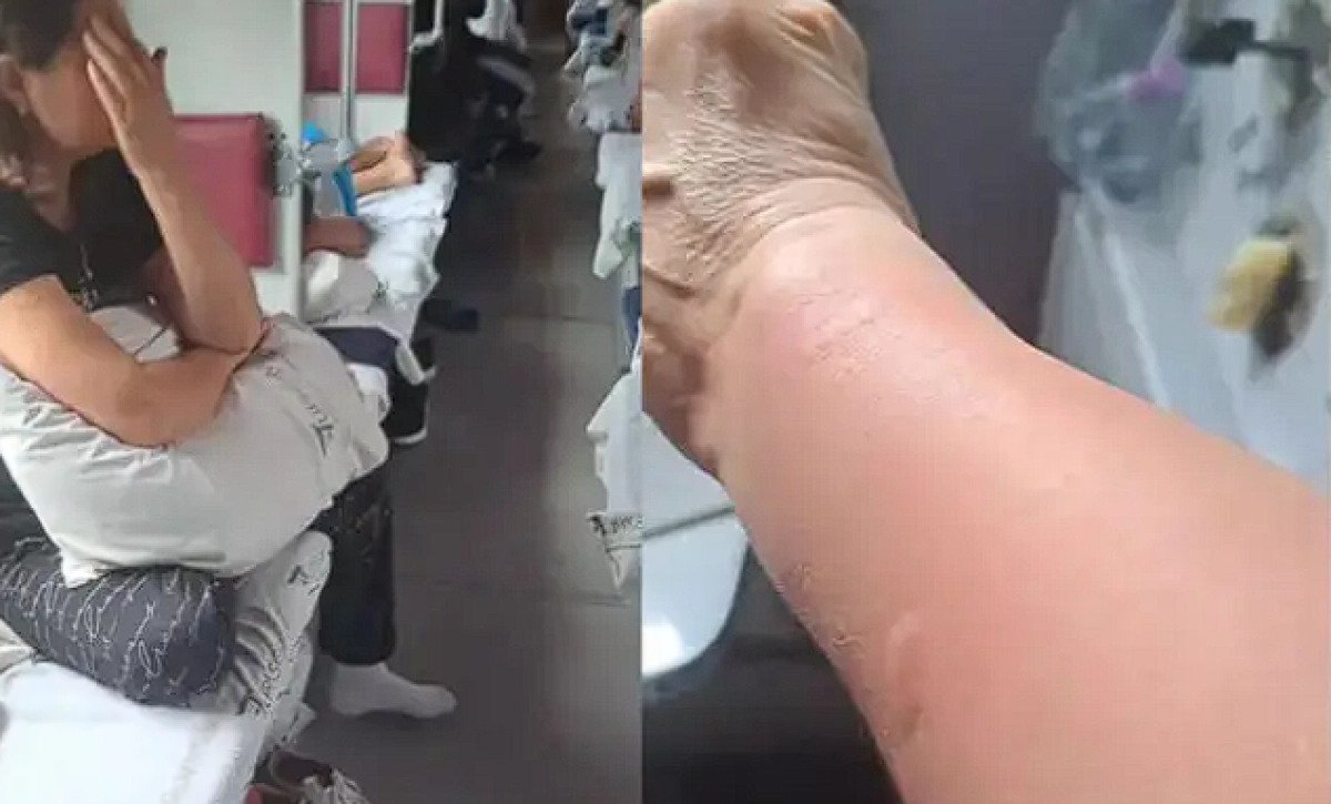 Пассажирку поезда Алматы-Костанай покусали клопы