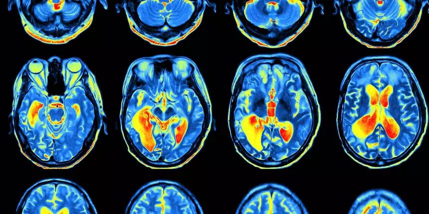 Ученые выяснили, как наш мозг отличает воображаемое от реальности