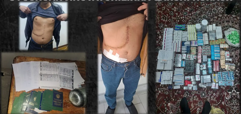 Торговлей человеческими органами и тканями занималась преступная группировка