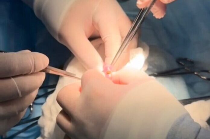 В Шымкенте трехлетний ребенок проглотил 16 магнитов