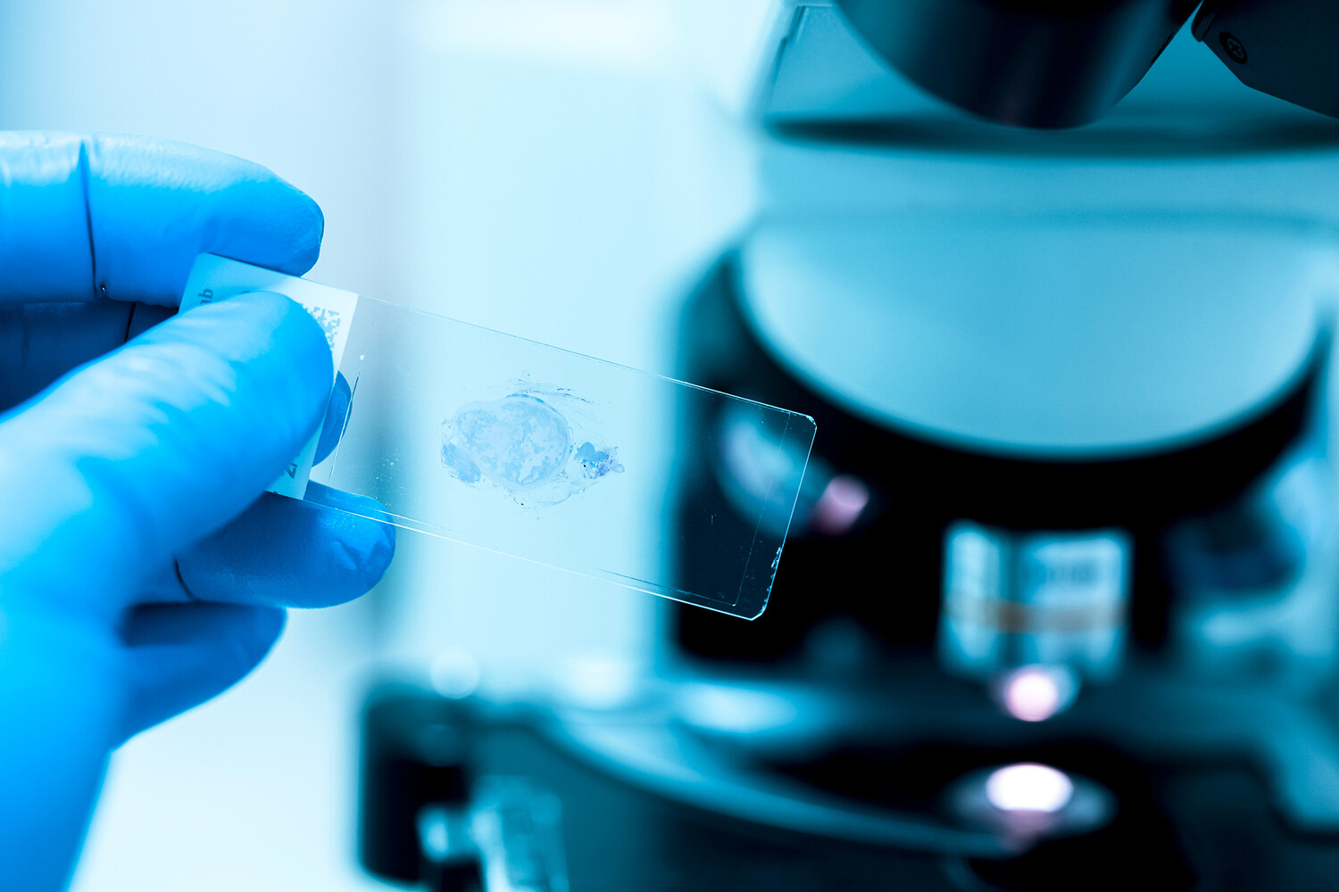 Назван тип питания, который снижает риски развития рака