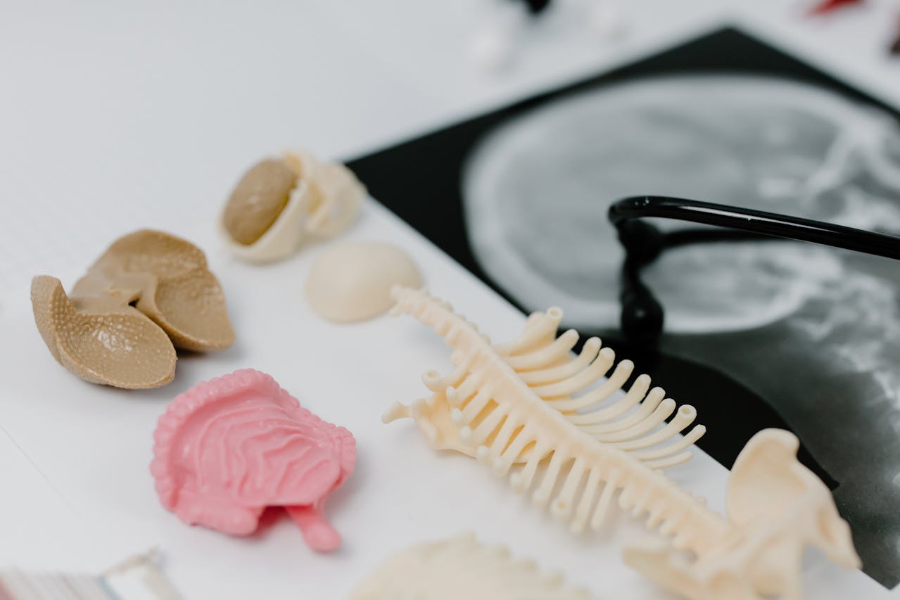 Названы провоцирующие образование камней в почках продукты