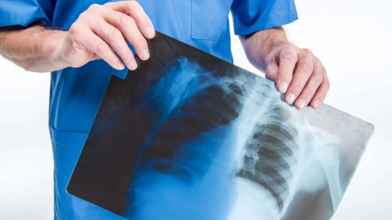 Еще 231 человек заболел коронавирусной пневмонией в РК