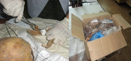 Исследование костных останков