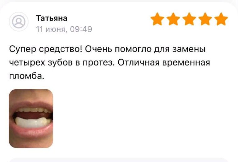 Самостоятельно установленные зубы. Не отличить от настоящих