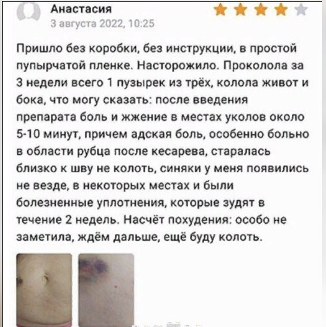 Это еще довольный клиент. Девушка поставила 4 звезды. Что же там с телами недовольных?