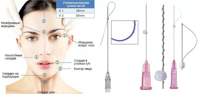 Ввести эти нити легко, а вот удалить...